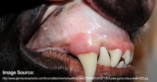 Discolored Gums